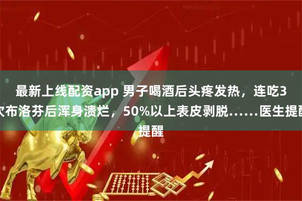 最新上线配资app 男子喝酒后头疼发热，连吃3次布洛芬后浑身溃烂，50%以上表皮剥脱……医生提醒